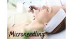 Microneedling